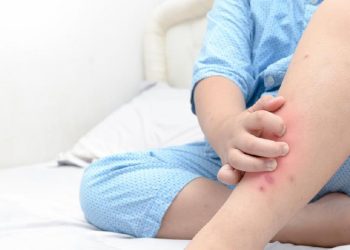 Memahami Perbedaan Gatal Umum dan Gatal Akibat Diabetes yang Perlu Diwaspadai