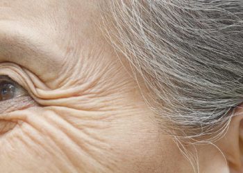 7 Penyebab Keriput di Bawah Mata yang Membuat Wajah Terlihat Tua