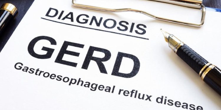 Apakah GERD Dapat Disembuhkan? Simak Penjelasan dari Dokter